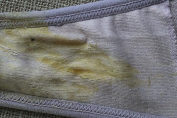 Ausfluss in meinem Höschen
