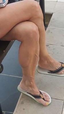 My sandal feet 1.