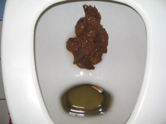 mi mierda