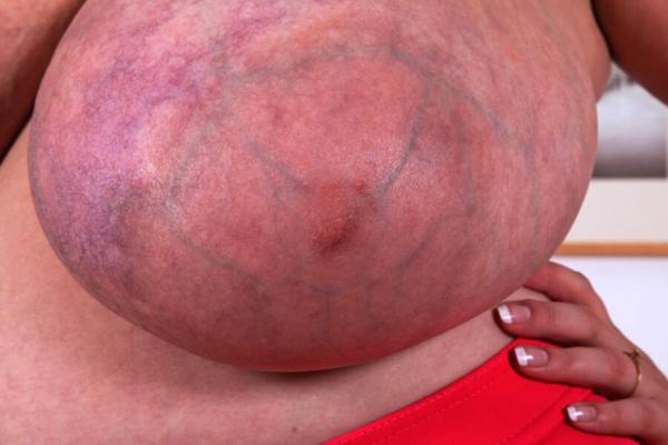 Areolas, magnificent and huge. Alice jj