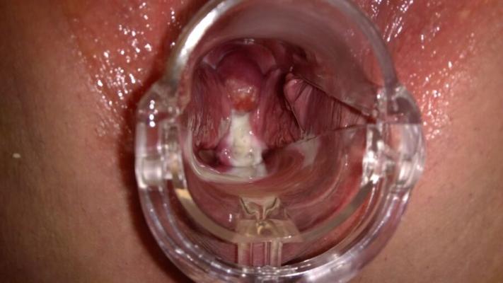 cuello uterino cremoso