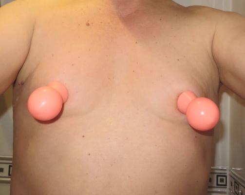 chupones de pezones