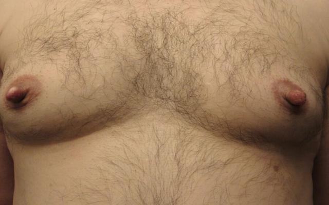 why men have nipples