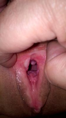Huge hole of my wife after fisting.