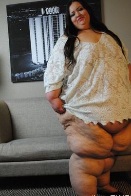 Applebomb SSBBW riesige Beine