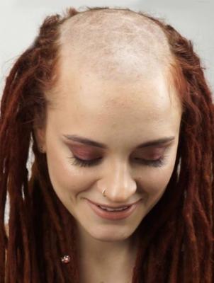 sub - Careca, zumbido ou baixo -