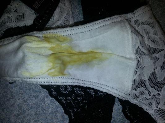 Frischer Vaginalausfluss