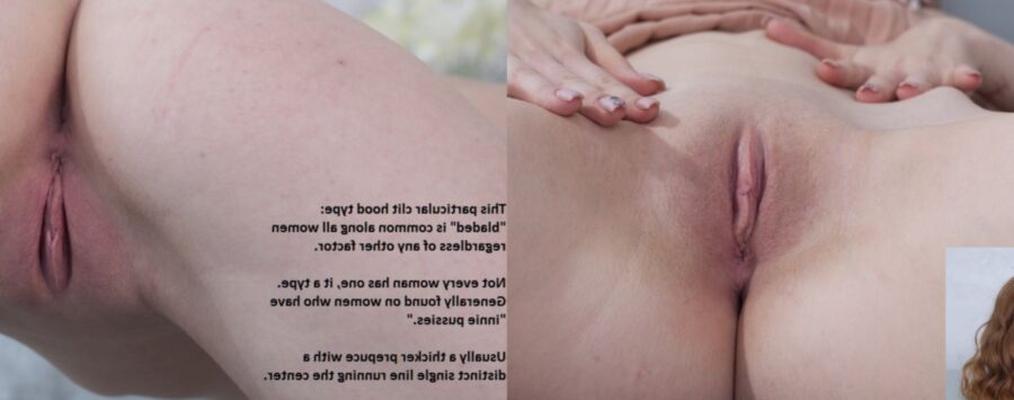 Klitorishaubentyp (mit Klinge)