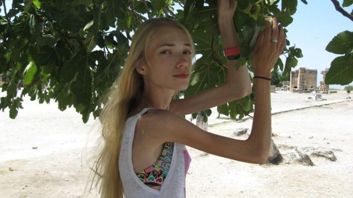 only anorexic girls canbe so hot;so sexy sind nur Magersüchtige