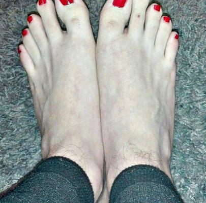 ROTE NÄGEL