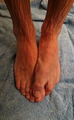 Male feet fetish