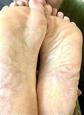 熟女ぽっちゃり系インド人主婦の肉厚な足の裏（クローズアップ）