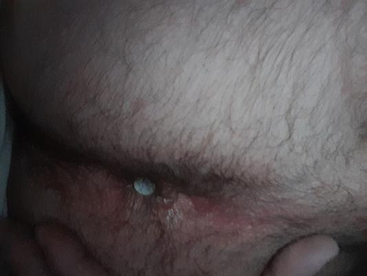座薬