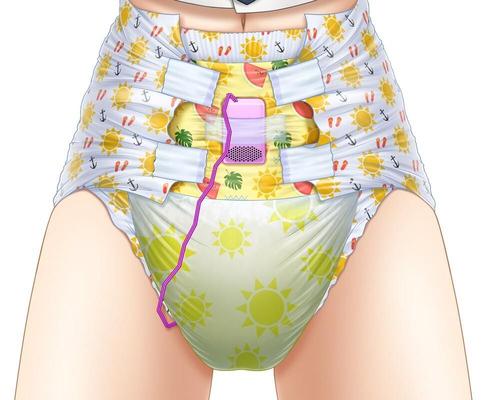 Rediffusion d'art ABDL