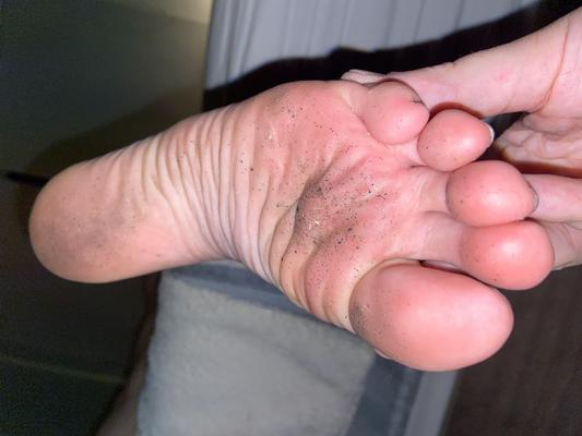 Eu Yo Yo Sujo e Smart Feet Soles depois de uma noite fora