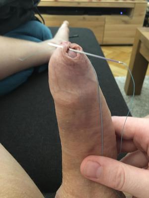 Foreskin games (sew foreskin)