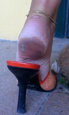 suelas descalzos y tacones de olor a queso de pie de pie