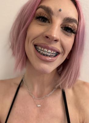 Brace Face Slut