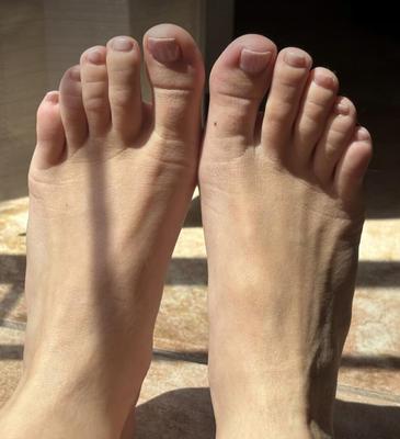 Kristins sexy soles and toes in the sunlight full set