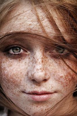 Les taches de rousseur sont putain de sexy