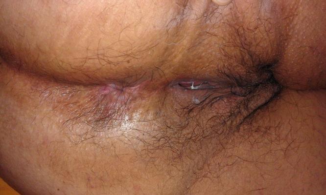 holes, beautiful assholes